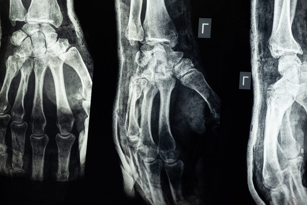 בדיקת MRI פרטית באזור מפרק כף היד